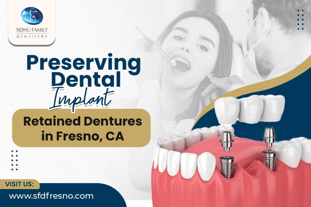 Preserving Dental Implant-Retained Dentures in Fresno, CA